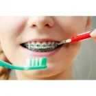 La imagen 3 de la Empresa ADRIANA PATRICIA BARBA R. ORTODONCISTA Ortodoncia en Cúcuta SAN