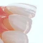 La imagen 1 de la Empresa ANTONIO LEON PERFECCIONAMIENTO DENTAL Odontología cosmética en Cali VAC