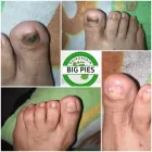 La imagen 5 de la Empresa BIG PIES PODOLOGIA Salón de belleza en Cali VAC