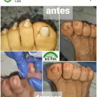 La imagen 7 de la Empresa BIG PIES PODOLOGIA Salón de belleza en Cali VAC