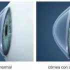 La imagen 1 de la Empresa CAT MEDICA Oftalmología pediátrica en Pereira RIS