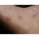 La imagen 3 de la Empresa CENTRO ALERGOLÓGICO DE RISARALDA Centro de salud en Pereira RIS