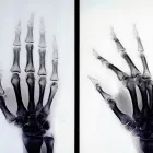 La imagen 1 de la Empresa CENTRO DE ORTOPEDIA Y FRACTURAS CLÍNICA DE LA RODILLA LTDA Ortopedia en Bogotá CUN