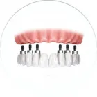 La imagen 2 de la Empresa CLINICA DE IMPLANTES DENTALES DEL SUR Protésico dental en Envigado ANT