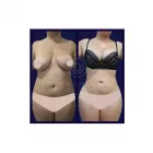 La imagen 1 de la Empresa DR. GUEVARA | CIRUGÍA PLÁSTICA | MAMOPLASTIA, RINOPLASTIA, Tienda de productos cosméticos en Bogotá, D.c. DC