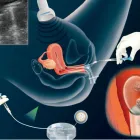 La imagen 2 de la Empresa DR. HECTOR RICARDO NARVAEZ ROSERO - ESPECIALISTAS EN ANDROLOGÍA Y MICROBILOGÍA Médico en Cali VAC