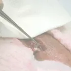 La imagen 4 de la Empresa DR. HECTOR RICARDO NARVAEZ ROSERO - ESPECIALISTAS EN ANDROLOGÍA Y MICROBILOGÍA Médico en Cali VAC