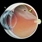 La imagen 4 de la Empresa DR. RICARDO VALDÉS RENDÓN Oftalmología pediátrica en Pereira RIS