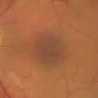 La imagen 5 de la Empresa DR. RICARDO VALDÉS RENDÓN Oftalmología pediátrica en Pereira RIS