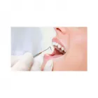La imagen 2 de la Empresa DR. URIEL MUÑOZ BUITRAGO Dentist en Armenia QUI