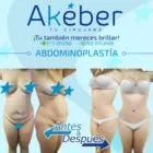 La imagen 2 de la Empresa DRA. AKEBER IBAÑEZ O'KAMELL Odontología en Barranquilla ATL