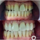 La imagen 2 de la Empresa DRA. ANGELA MARIA CARDONA Periodoncista de implantes dentales en Armenia QUI