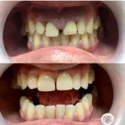 La imagen 5 de la Empresa DRA. ANGELA MARIA CARDONA Periodoncista de implantes dentales en Armenia QUI