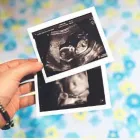 La imagen 4 de la Empresa ECODIAGNÓSTICO IPS SANTA MARTA S.A.S Radiografía y diagnóstico por imagen en Santa Marta MAG