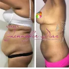 La imagen 1 de la Empresa IPS SAMIES DRA. JENNIFFER DÍAZ Odontología en Barranquilla ATL