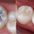 La imagen 1 de la Empresa JUAN DAVID RESTREPO GONZALEZ- ENVIGADO ORAL Periodoncista de implantes dentales en Envigado ANT