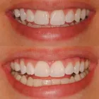 La imagen 2 de la Empresa JUAN DAVID RESTREPO GONZALEZ- ENVIGADO ORAL Periodoncista de implantes dentales en Envigado ANT