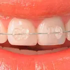 La imagen 3 de la Empresa JUAN DAVID RESTREPO GONZALEZ- ENVIGADO ORAL Periodoncista de implantes dentales en Envigado ANT