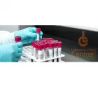 La imagen 5 de la Empresa LABORATORIO CLÍNICO CENTRAL LTDA. Laboratorio de análisis clínicos en Ibagué TOL