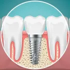 La imagen 2 de la Empresa LABORATORIO DENTAL PROCEDENTAL Tienda de productos cosméticos en Pereira RIS