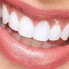 La imagen 3 de la Empresa ODONTOLOGÍA ESTÉTICA E IMPLANTOLOGIA Odontología en Ibagué TOL