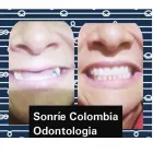 La imagen 5 de la Empresa ODONTOLOGÍA SONRÍE COLOMBIA Odontología cosmética en Bogotá, D.c. DC