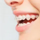 La imagen 4 de la Empresa ORALCLINIC Periodoncista de implantes dentales en Medellín ANT