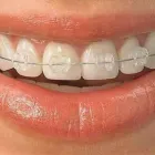 La imagen 1 de la Empresa ORTO DENT Periodoncia en Manizales CAL
