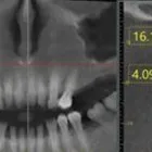 La imagen 1 de la Empresa RADIOLOGIA ORAL CRA SAS Radiología en Bogotá DC