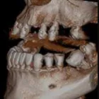 La imagen 2 de la Empresa RADIOLOGIA ORAL CRA SAS Radiología en Bogotá DC