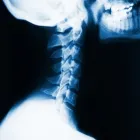 La imagen 2 de la Empresa UNIDAD MÚSCULO ESQUELÉTICA Ortopedia en Medellín ANT