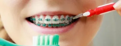 La imagen 3 de la Empresa ADRIANA PATRICIA BARBA R. ORTODONCISTA Ortodoncia en Cúcuta SAN