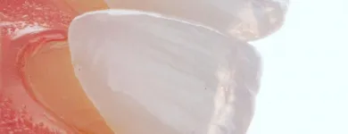 La imagen 1 de la Empresa ANTONIO LEON PERFECCIONAMIENTO DENTAL Odontología cosmética en Cali VAC