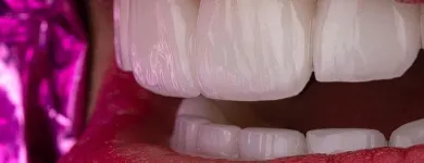 La imagen 3 de la Empresa ANTONIO LEON PERFECCIONAMIENTO DENTAL Odontología cosmética en Cali VAC