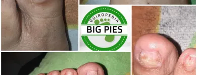 La imagen 5 de la Empresa BIG PIES PODOLOGIA Salón de belleza en Cali VAC