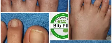 La imagen 6 de la Empresa BIG PIES PODOLOGIA Salón de belleza en Cali VAC