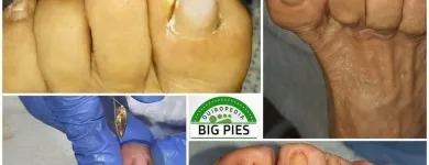 La imagen 7 de la Empresa BIG PIES PODOLOGIA Salón de belleza en Cali VAC