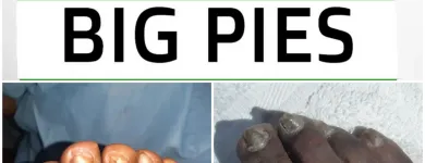 La imagen 9 de la Empresa BIG PIES PODOLOGIA Salón de belleza en Cali VAC