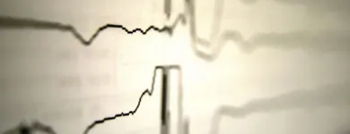 La imagen 5 de la Empresa CARDIUM LTDA. Pruebas y controles médicos en Bogotá DC