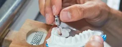 La imagen 1 de la Empresa CARLOS ALBERTO RENGIFO LOZANO Odontología en Cali VAC