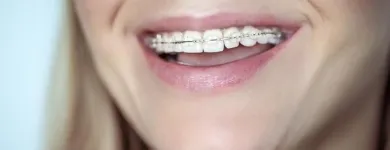 La imagen 2 de la Empresa CARLOS ALBERTO RENGIFO LOZANO Odontología en Cali VAC