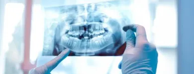 La imagen 4 de la Empresa CARLOS ALBERTO RENGIFO LOZANO Odontología en Cali VAC