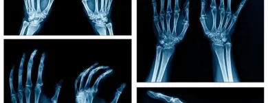 La imagen 1 de la Empresa CEDICAF Radiología en Ibagué TOL
