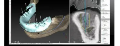 La imagen 4 de la Empresa CLINICA DE IMPLANTES DENTALES DEL SUR Protésico dental en Envigado ANT