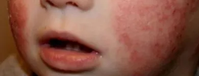 La imagen 2 de la Empresa CLINICA DEL ASMA SANTA CLARA Pruebas y controles médicos en Bogotá DC