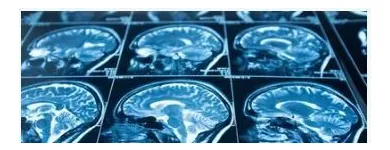 La imagen 4 de la Empresa CLÍNICA NEUROPSICOLOGICA INTEGRAL NEURAXIS IPS S.A.S Terapia ocupacional en Ibagué TOL