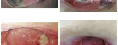 La imagen 2 de la Empresa CUIDAR SALUD IPS Vacunación en Cali VAC