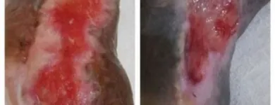 La imagen 4 de la Empresa CUIDAR SALUD IPS Vacunación en Cali VAC