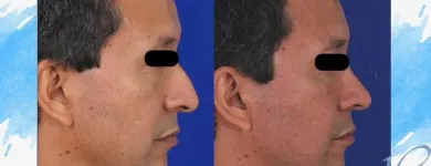 La imagen 1 de la Empresa DR JORGE ALIRIO HOLGUÍN RUIZ Otorrinolaringología en Cali VAC