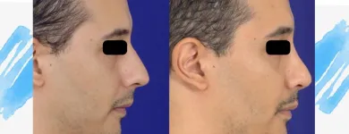 La imagen 2 de la Empresa DR JORGE ALIRIO HOLGUÍN RUIZ Otorrinolaringología en Cali VAC